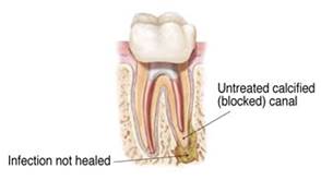 Endodontic Specialist of Oakhurst